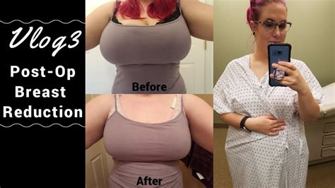 Teen with 34L breasts fundraising for reduction surgery after Big。